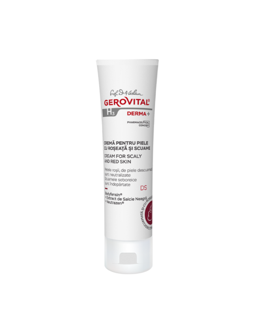 Cream for scaly and red skin